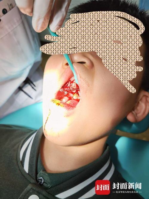 重慶特斯拉車(chē)主遭遇驚魂一幕 停車(chē)時(shí)車(chē)輛自動(dòng)加速撞墻，致孩子受傷